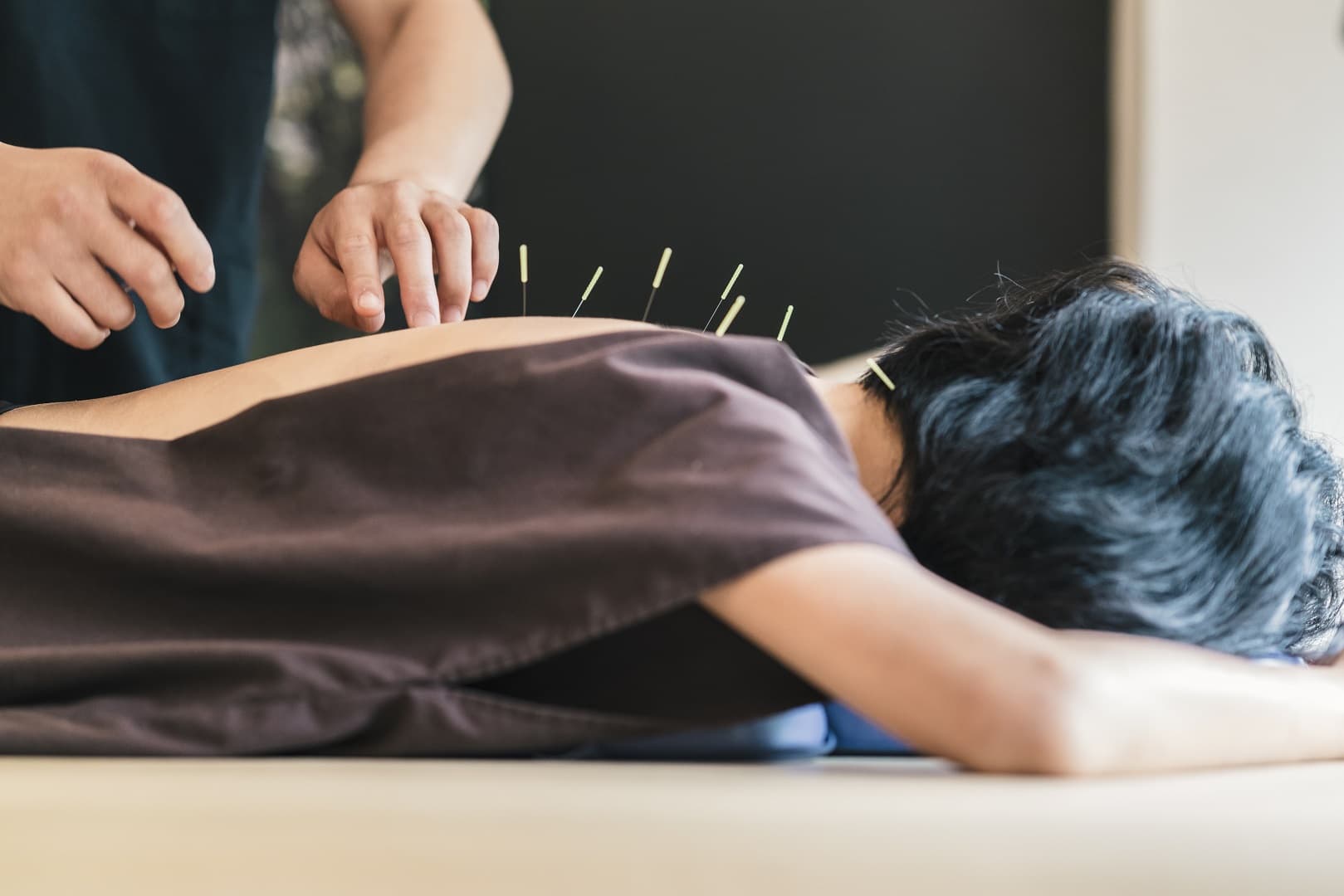 Acupuncture Courses in Australia